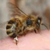 چگونه با نیش زنبور مواجه شویم؟